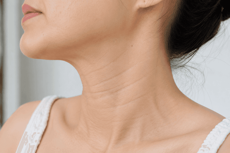 XOÁ NHĂN CỔ: VÙNG LÃO HOÁ SỚM NHƯNG THƯỜNG BỊ BỎ QUÊN